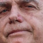 Bolsonaro apresenta piora clínica e vai passar por novos exames
