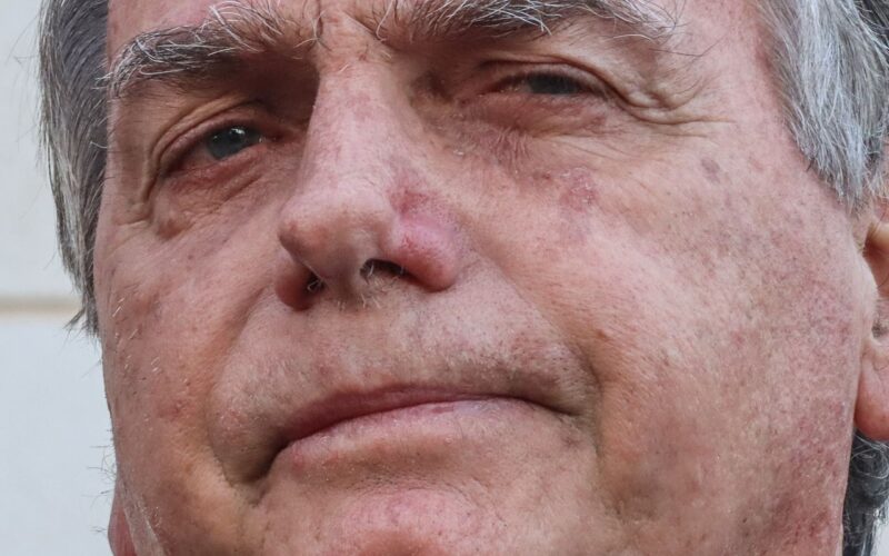 Bolsonaro apresenta piora clínica e vai passar por novos exames