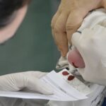 Saúde aumenta em 30% recursos para programa do teste do pezinho