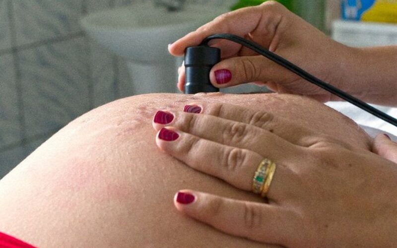 Exame pré-natal reduz chance de bebê nascer com anomalia