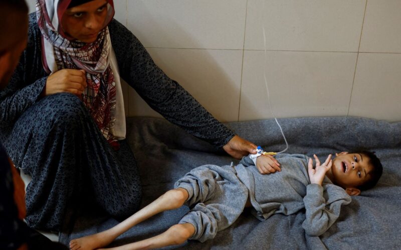 FAO aponta que fome chegou a pior patamar em Gaza