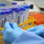 Laboratório Central de Saúde Pública de SC completa 74 anos de pioneirismo na vigilância em saúde