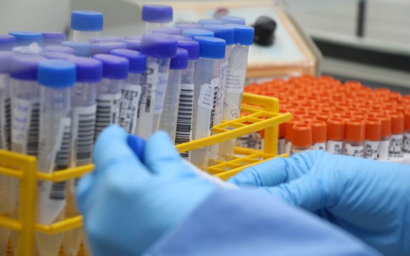 Laboratório Central de Saúde Pública de SC completa 74 anos de pioneirismo na vigilância em saúde
