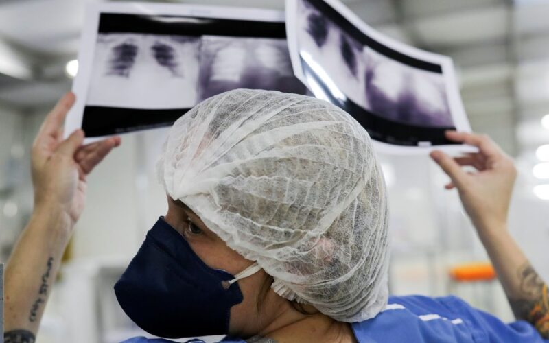 Câncer de pulmão: 15% dos casos acontecem em não fumantes