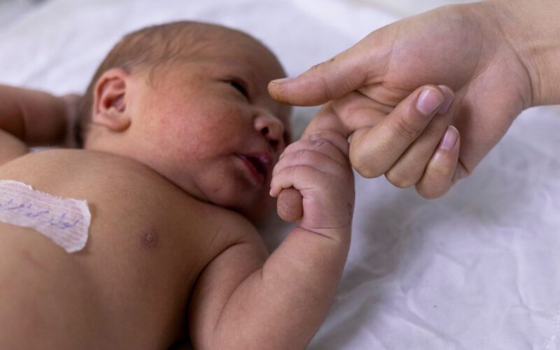 Teste do olhinho deve ser repetido três vezes ao ano até os 3 anos